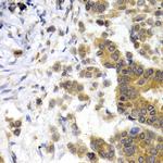 NEFL Antibody in Immunohistochemistry (Paraffin) (IHC (P))