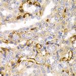 NEFL Antibody in Immunohistochemistry (Paraffin) (IHC (P))