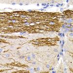 NEFL Antibody in Immunohistochemistry (Paraffin) (IHC (P))