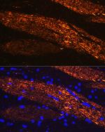 NEFL Antibody in Immunohistochemistry (Paraffin) (IHC (P))