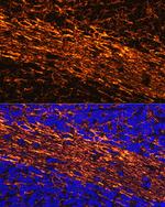 NEFL Antibody in Immunohistochemistry (Paraffin) (IHC (P))