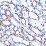 NME1 Antibody in Immunohistochemistry (Paraffin) (IHC (P))