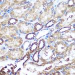 NME1 Antibody in Immunohistochemistry (Paraffin) (IHC (P))