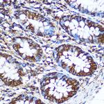 NME1 Antibody in Immunohistochemistry (Paraffin) (IHC (P))