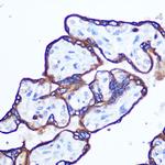 RhoA Antibody in Immunohistochemistry (Paraffin) (IHC (P))