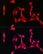 SOD1 Antibody in Immunocytochemistry (ICC/IF)