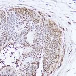 SOD1 Antibody in Immunohistochemistry (Paraffin) (IHC (P))