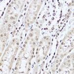 SOD1 Antibody in Immunohistochemistry (Paraffin) (IHC (P))