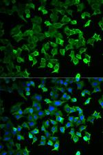 HSP70 Antibody in Immunocytochemistry (ICC/IF)