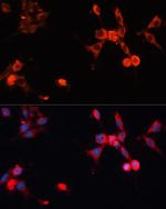 HSP70 Antibody in Immunocytochemistry (ICC/IF)