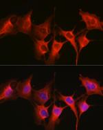 HSP70 Antibody in Immunocytochemistry (ICC/IF)