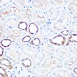 HSP70 Antibody in Immunohistochemistry (Paraffin) (IHC (P))