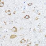 HSP70 Antibody in Immunohistochemistry (Paraffin) (IHC (P))