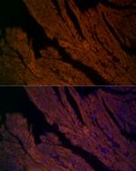 RyR2 Antibody in Immunocytochemistry (ICC/IF)