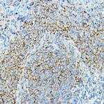 CD79a Antibody in Immunohistochemistry (Paraffin) (IHC (P))