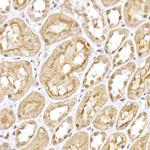 VHL Antibody in Immunohistochemistry (Paraffin) (IHC (P))