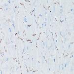 N-cadherin Antibody in Immunohistochemistry (Paraffin) (IHC (P))