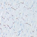 N-cadherin Antibody in Immunohistochemistry (Paraffin) (IHC (P))