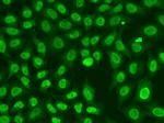 CHK2 Antibody in Immunocytochemistry (ICC/IF)