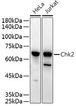 CHK2 Antibody in Western Blot (WB)