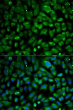 eIF4E Antibody in Immunocytochemistry (ICC/IF)