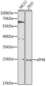 eIF4E Antibody in Western Blot (WB)