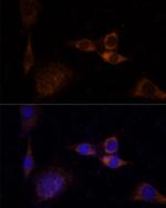 PKC delta Antibody in Immunocytochemistry (ICC/IF)