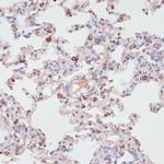 PKC delta Antibody in Immunohistochemistry (Paraffin) (IHC (P))