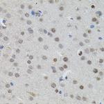 n-Myc Antibody in Immunohistochemistry (Paraffin) (IHC (P))