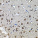 n-Myc Antibody in Immunohistochemistry (Paraffin) (IHC (P))