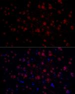 n-Myc Antibody in Immunohistochemistry (Paraffin) (IHC (P))