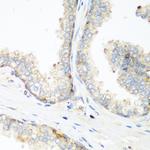 NEDD4 Antibody in Immunohistochemistry (Paraffin) (IHC (P))