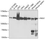 PKN1 Antibody in Western Blot (WB)