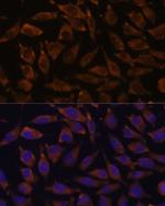 NOTCH2 Antibody in Immunocytochemistry (ICC/IF)