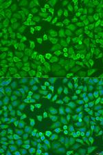 eIF3a Antibody in Immunocytochemistry (ICC/IF)