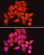 MYPT1 Antibody in Immunocytochemistry (ICC/IF)