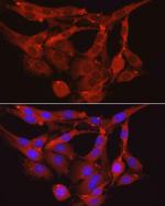 MYPT1 Antibody in Immunocytochemistry (ICC/IF)