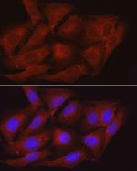 MYPT1 Antibody in Immunocytochemistry (ICC/IF)