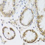 ATP1A1 Antibody in Immunohistochemistry (Paraffin) (IHC (P))