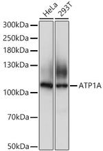 ATP1A1 Antibody in Western Blot (WB)