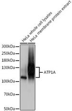 ATP1A1 Antibody in Western Blot (WB)