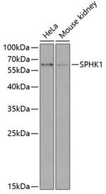 SPHK1 Antibody in Western Blot (WB)