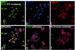 MMP7 Antibody in Immunocytochemistry (ICC/IF)