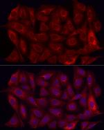 MMP7 Antibody in Immunocytochemistry (ICC/IF)