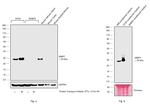 MMP7 Antibody in Western Blot (WB)