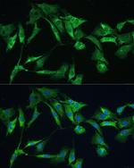 Ezrin Antibody in Immunocytochemistry (ICC/IF)