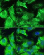 Ezrin Antibody in Immunocytochemistry (ICC/IF)