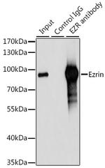 Ezrin Antibody in Immunoprecipitation (IP)