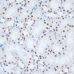 HMGB1 Antibody in Immunohistochemistry (Paraffin) (IHC (P))