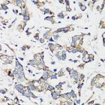 TSC1 Antibody in Immunohistochemistry (Paraffin) (IHC (P))